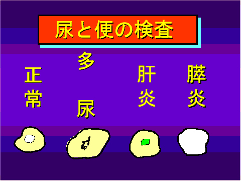 尿と便の検査05