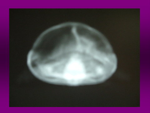 カメのX線検査05