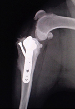 手術後のX線写真