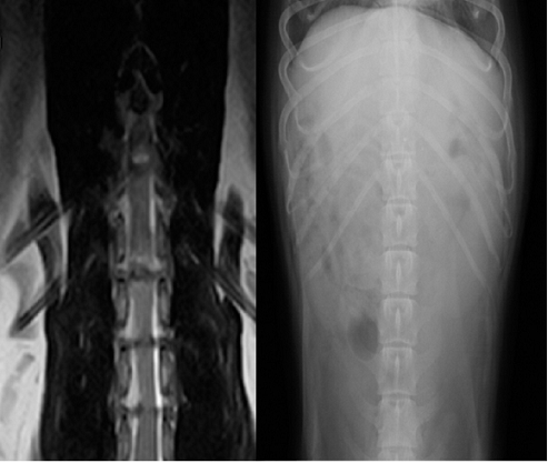 造影なしのT2強調画像01