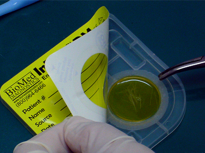 培地に載せる所